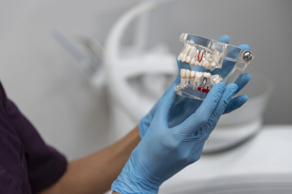 زراعة الأسنان هي أفضل حل لتعويض الأسنان المفقودة بشكل دائم، حيث يتم تركيب جذر صناعي من التيتانيوم داخل عظام الفك ثم وضع تاج ثابت يمنحك ابتسامة طبيعية