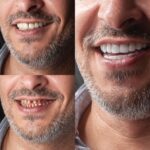 زراعة و تجميل الاسنان