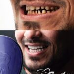 فينير-الاسنان-هيغير-شكل-حياتك-.-عيادة-اسنان-فى-المهندسين