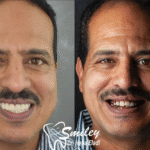 زراعة اسنان فى عيادة اسنان عن الزرارعة فى عيادة اسنان فى مصر و توضحك كيف فيرت من شكل المريض . مركز زراعة اسنان