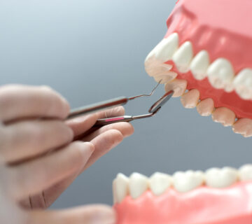 زراعة الأسنان في مصر 2025- خطوات زراعة الأسنان بالصور: من الاستشارة إلى التعافي فى عيادة اسنان دكتورة هبة العدل