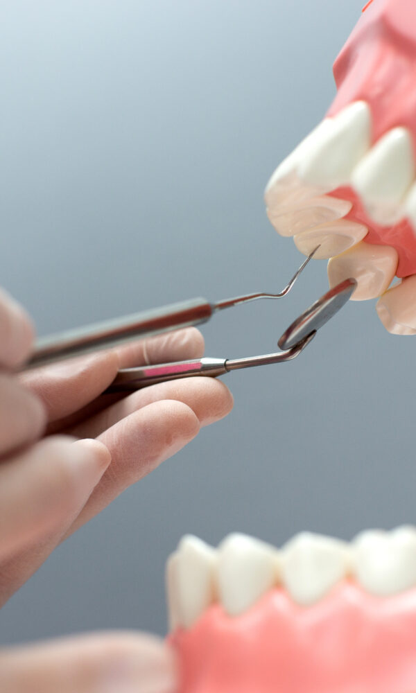 زراعة الأسنان في مصر 2025- خطوات زراعة الأسنان بالصور: من الاستشارة إلى التعافي فى عيادة اسنان دكتورة هبة العدل