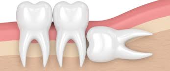 جراحة الوجة و الفكيين - الصورة 3