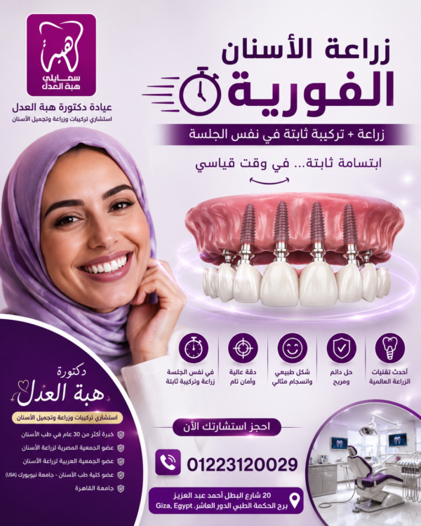 زراعة اسنان فورية . عيادة دكتورة هبة العدل